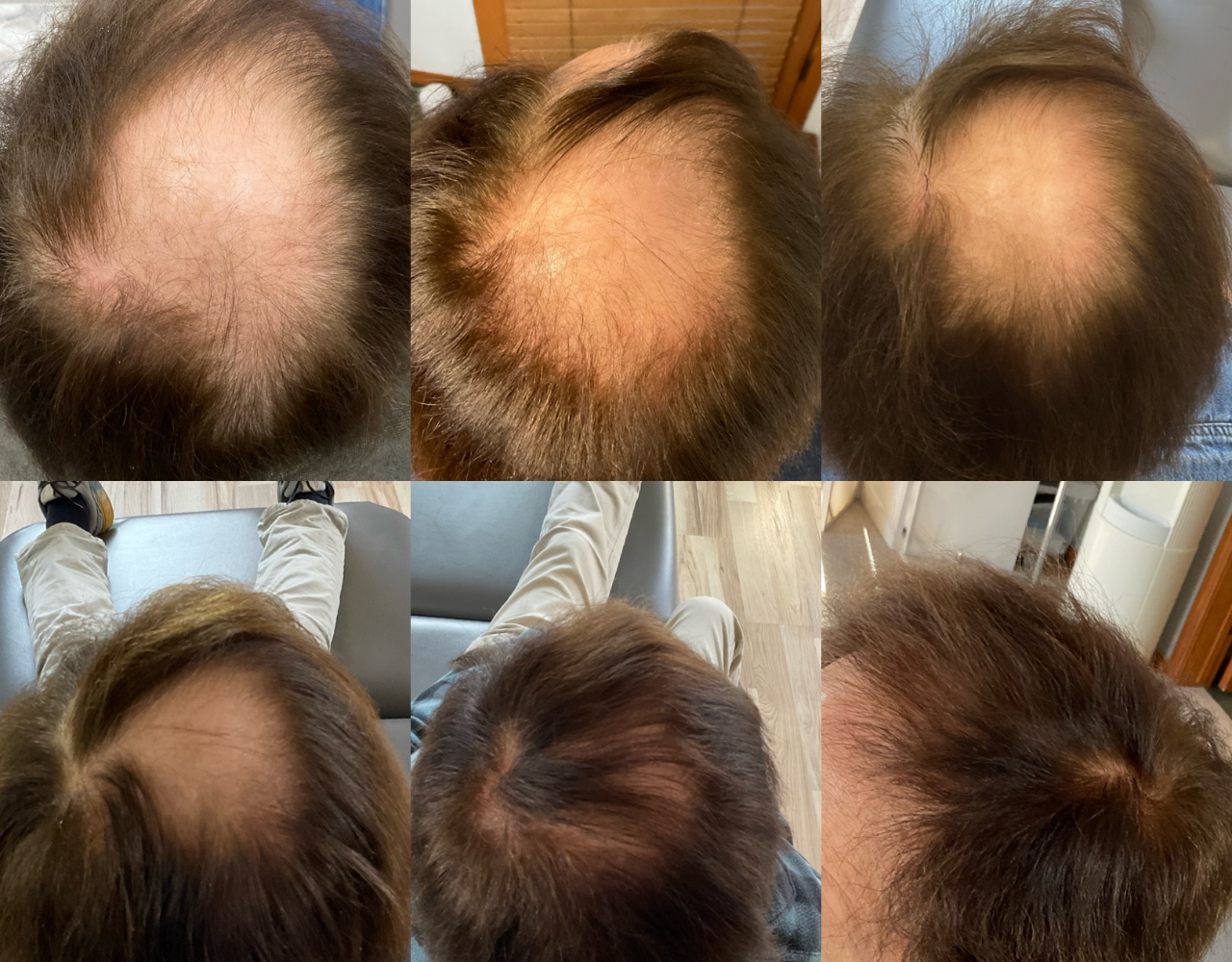 hair rest man right size hair rest man right size