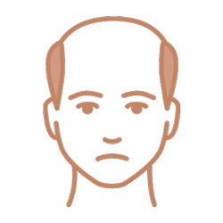 Mens Hair Loss Icon